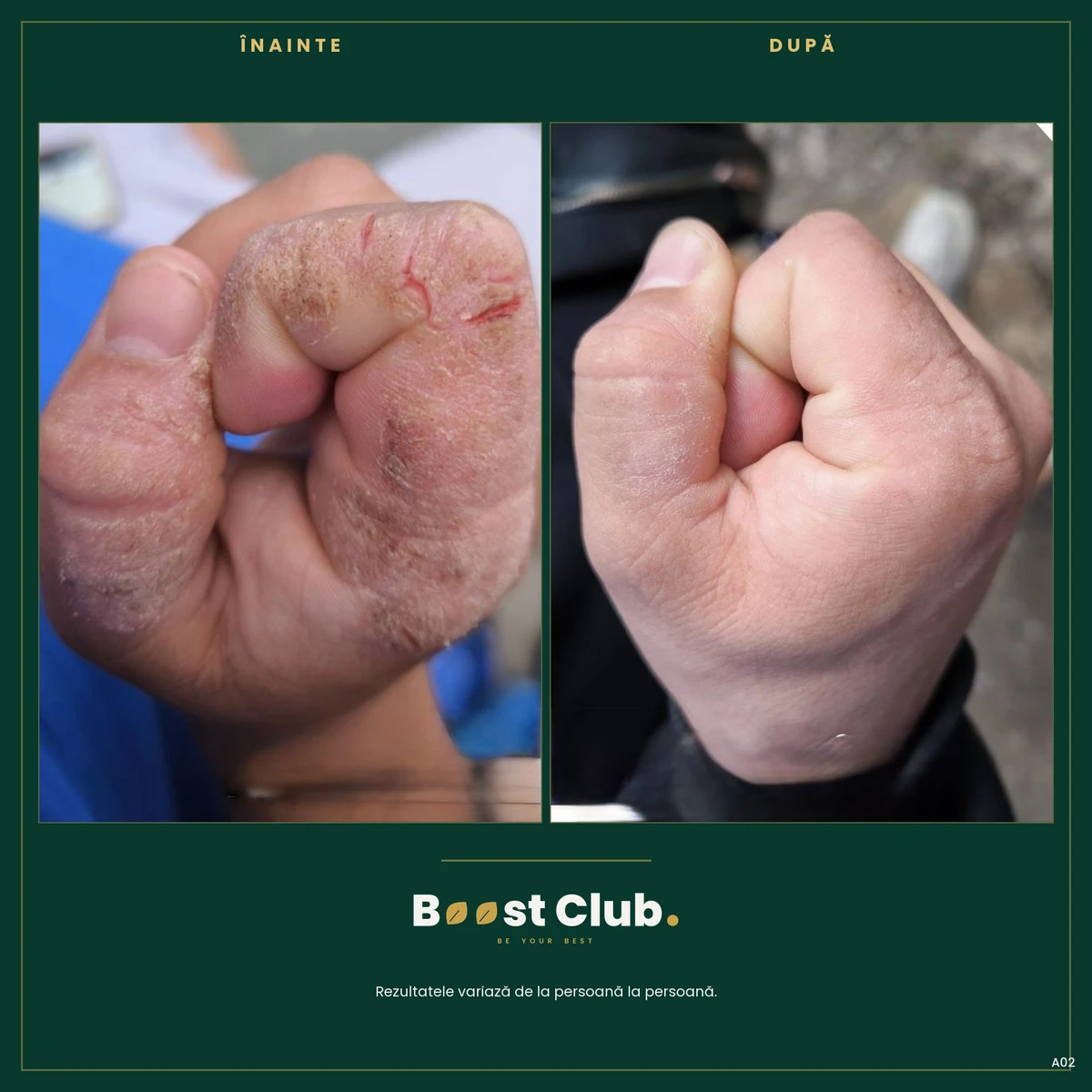 Before and after, transformation 2